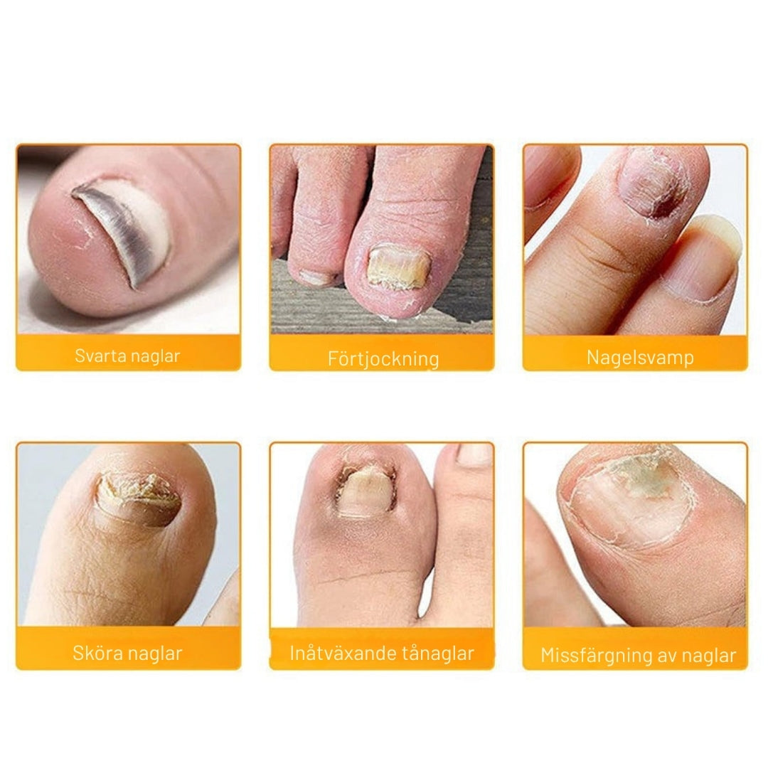NagelNatt – Naturlig behandling för friska tånaglar