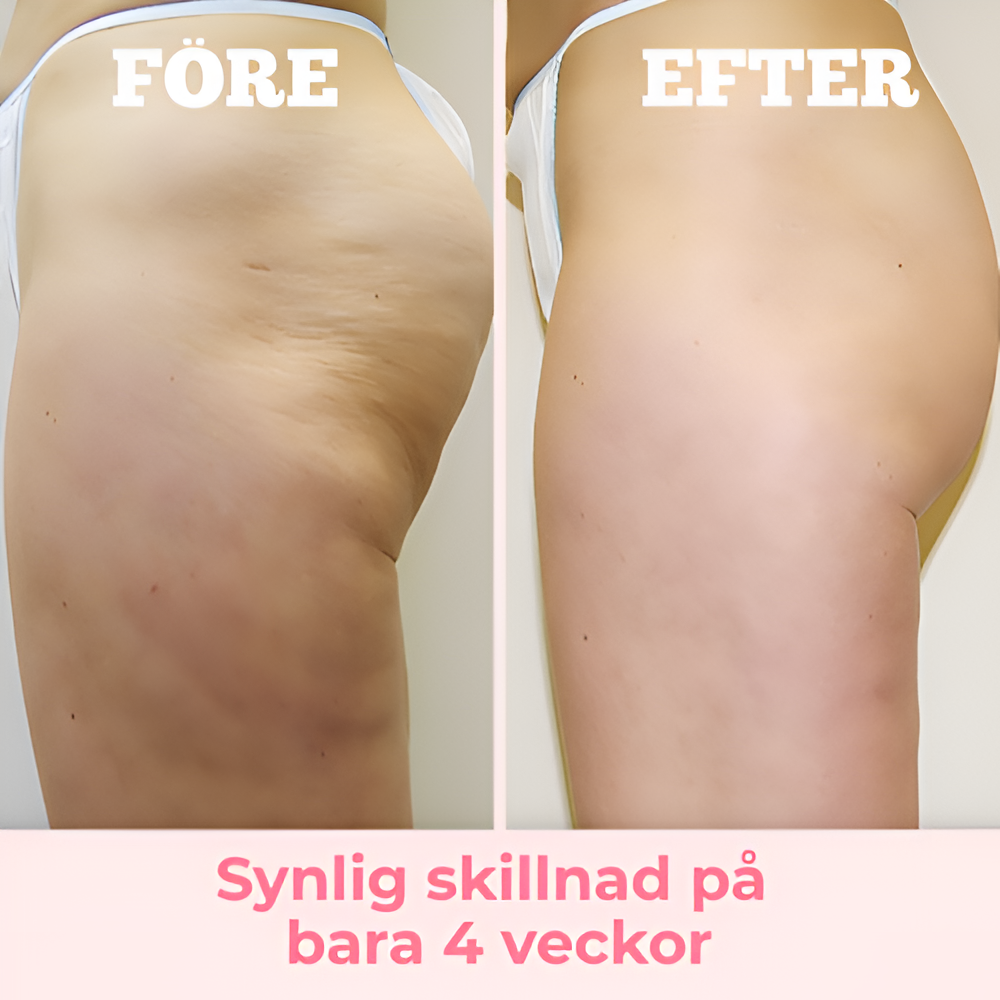 Sculptura – Massagerullen som formar, slätar och frigör