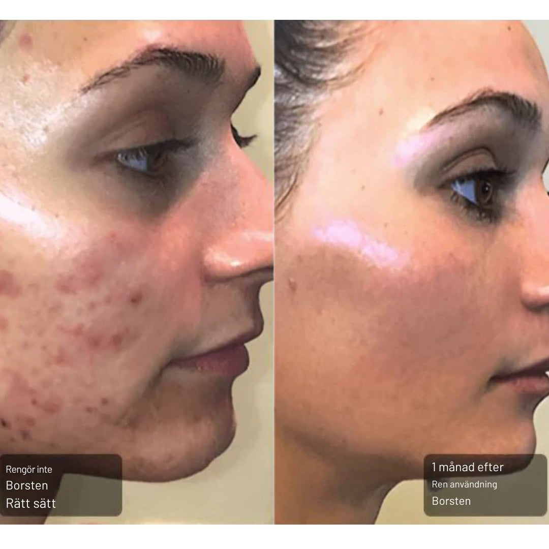 Kindu Borstrengöring – För Fräsch Makeup och Strålande Hud